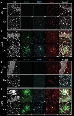 Evaluation of cannabinoid type 2 receptor expression and pyridine-based radiotracers in brains from a mouse model of Alzheimer’s disease